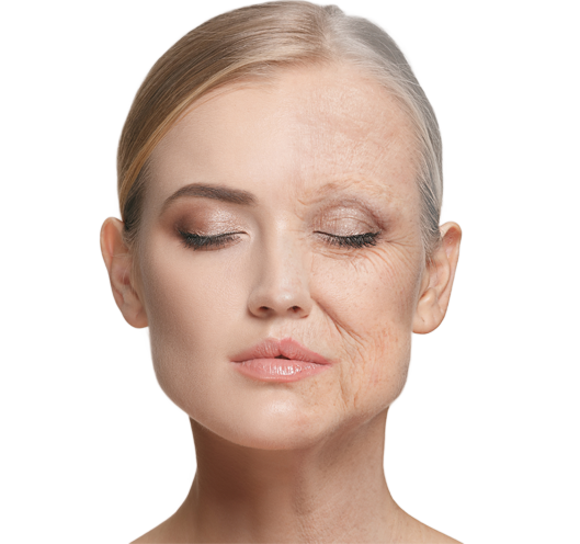 Before and After results of a wrinkle reduction procedure at Beauty Clinic Mallorca