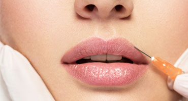 Restoring facial volume with dermal fillers